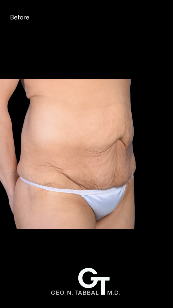 Before